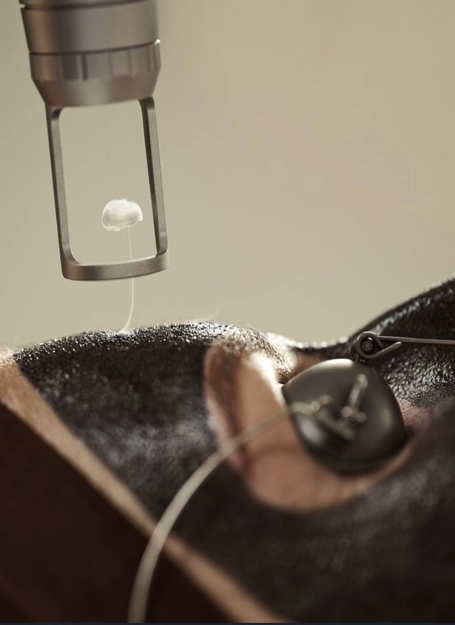 Carbon Laser Facial NYC at Lumera Skin Lab