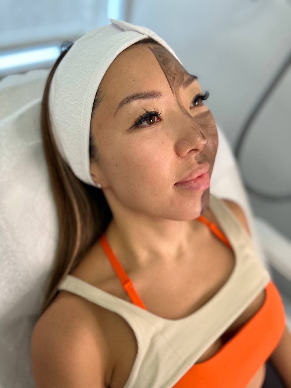 Zero downtime results from Carbon Laser Facial NYC.